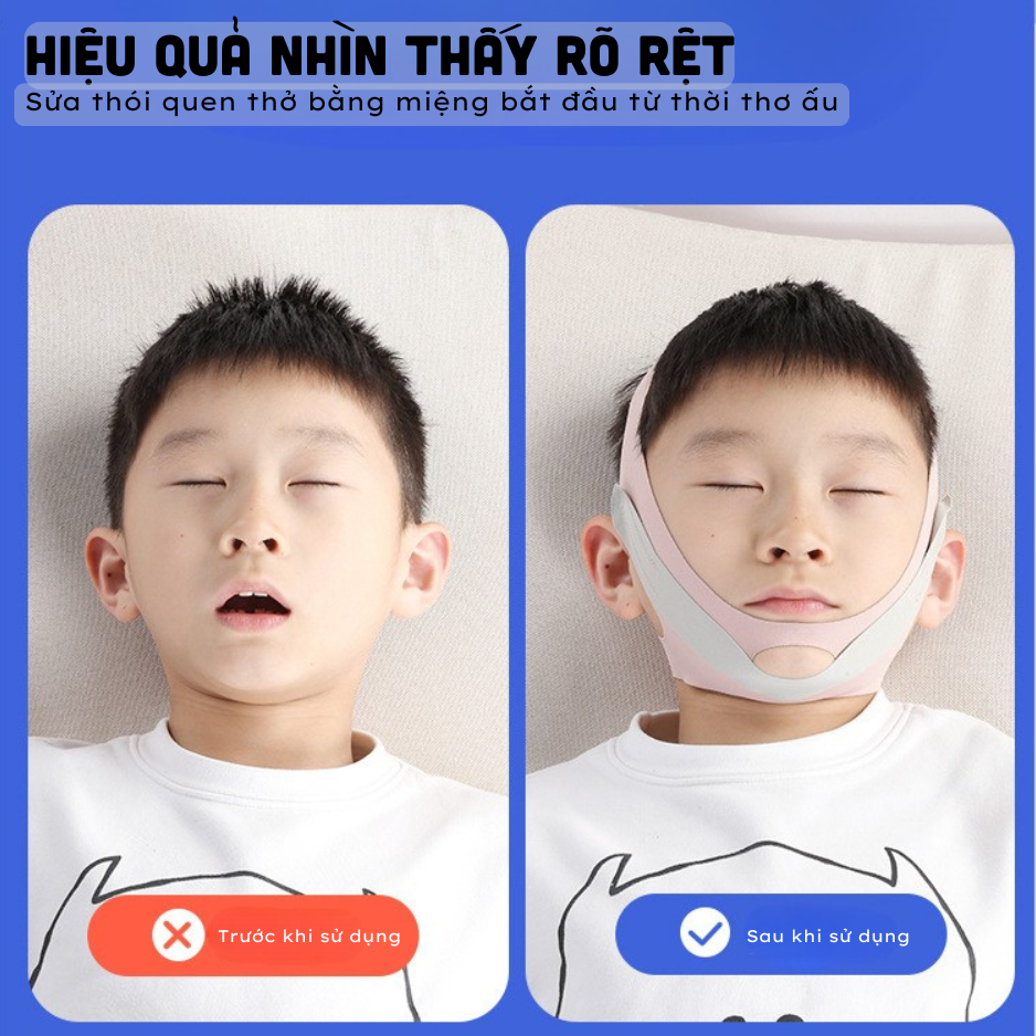 (Mẫu 2) Đai Điều Chỉnh Chống Ngáy, Chống Hở Miệng Tiện Ích Giúp Ngủ Ngon Cho Bé Nam Và Bé Gái - Hàng Nhập Khẩu