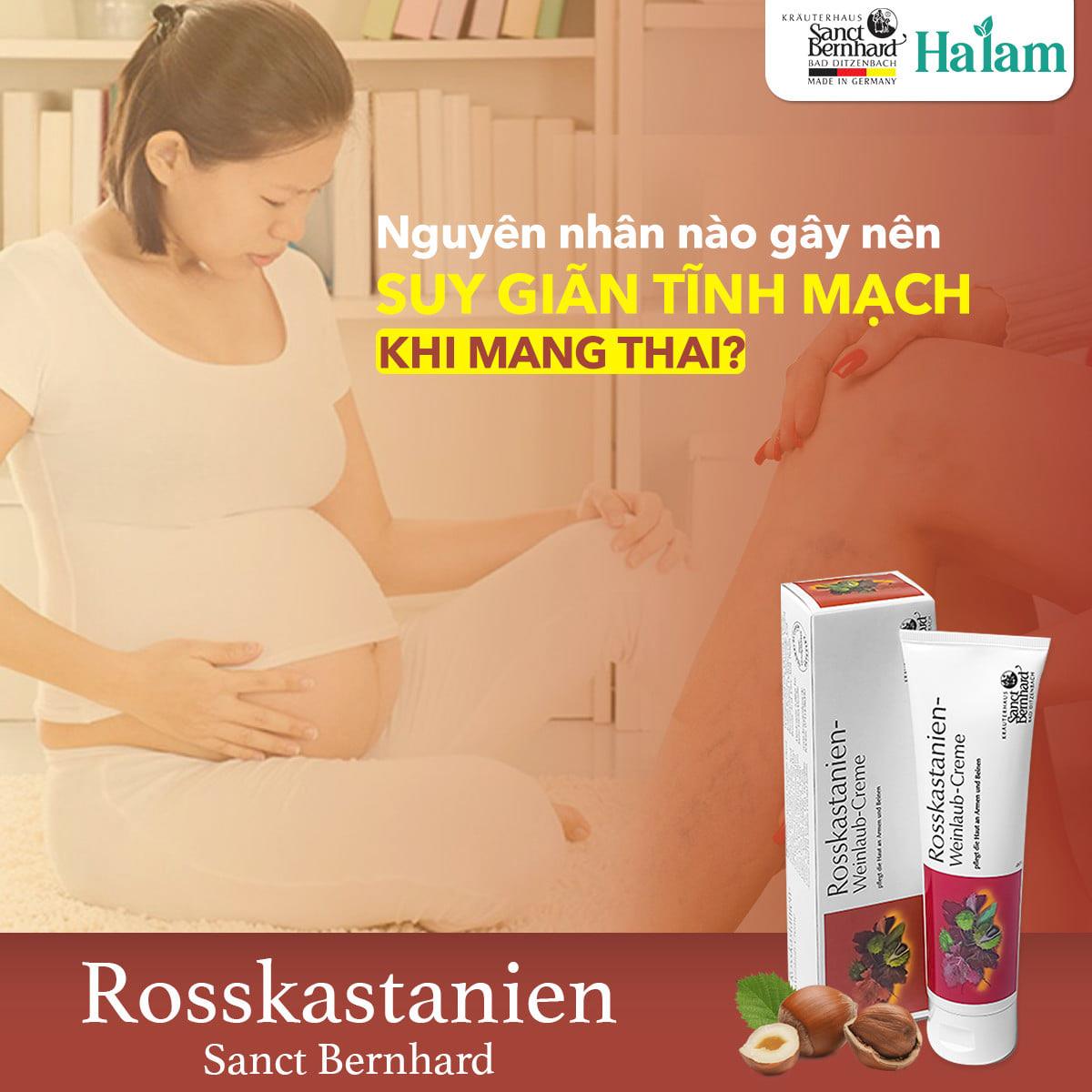 Kem bôi suy giãn tĩnh mạch Rosskastanien hạt dẻ ngựa giảm đau, tuần hoàn máu (tuýp 150ml)