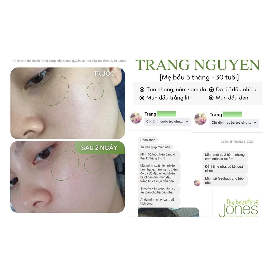 Dầu tẩy trang dành da mụn nhạy cảm The Beauty of Jones 100ml