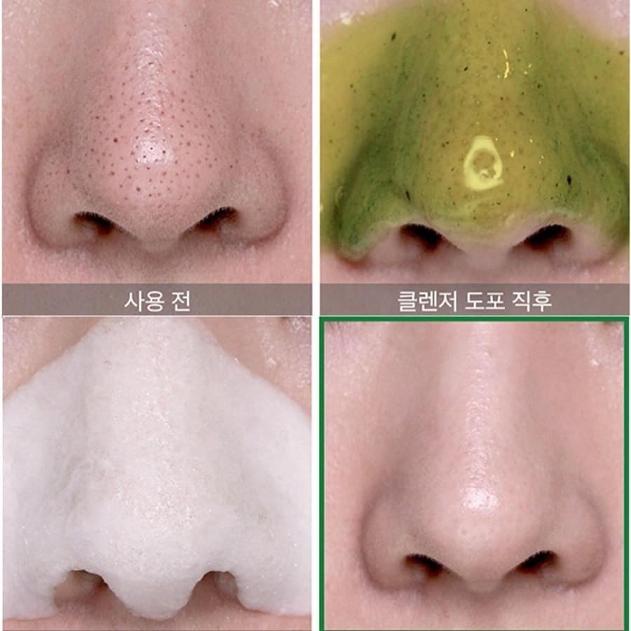 Bộ 4 SP Dưỡng Da Ngừa Mụn Some By Mi AHA-BHA-PHA 30Days Miracle