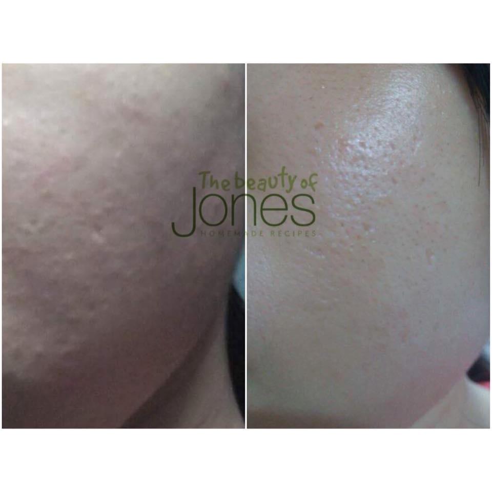 Combo 2 tuýp Sữa rửa mặt da mụn nhạy cảm từ trà xanh tảo biển The Beauty of Jones