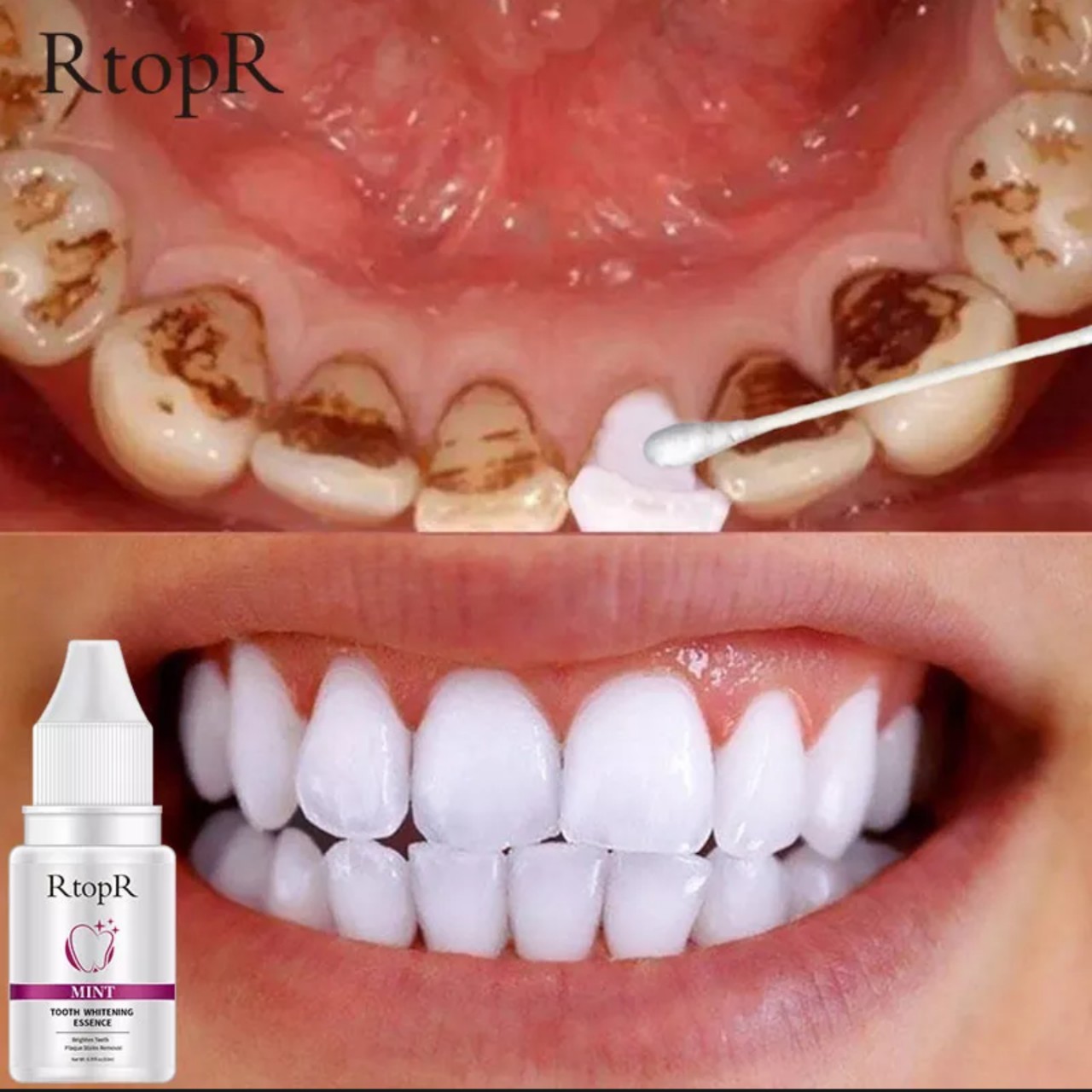Tinh chất làm trắng răng , serum làm sạch loại bỏ mảng bám vết bẩn trên răng hiệu quả cao