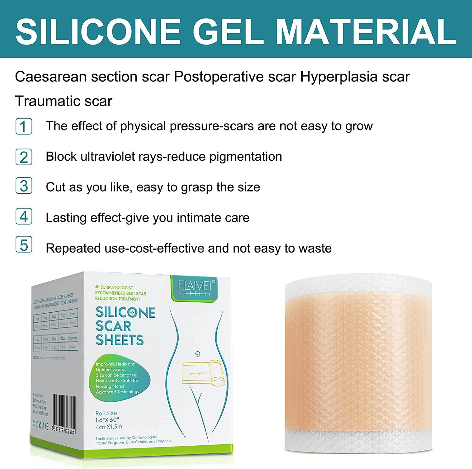 Silicone Scar Dressing để lá từ vết sẹo silicone cho sinh mổ, phẫu thuật, bỏng, sẹo, sẹo do mụn trứng cá