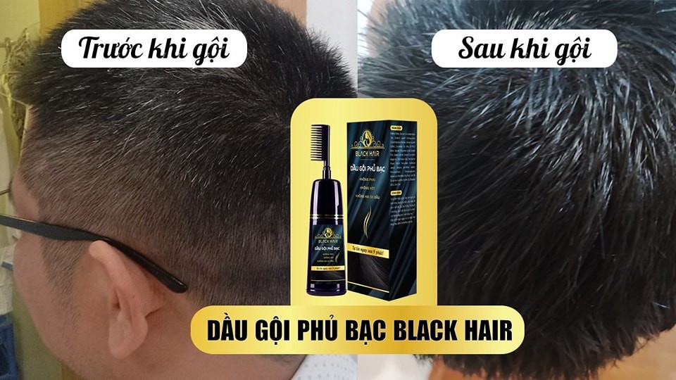 Dầu Gội Phủ Bạc BackHair Vạn Tam Chính Hãng