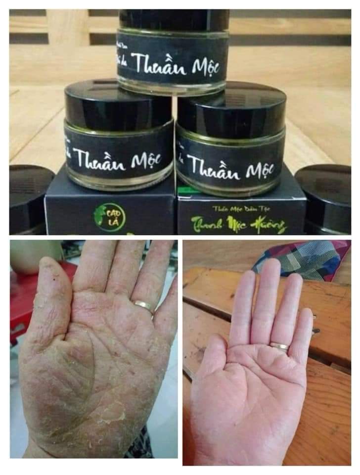 Combo kem bôi da thuần mộc & cao lá trị rạn nứt nẻ da Thanh Mộc Hương 50g