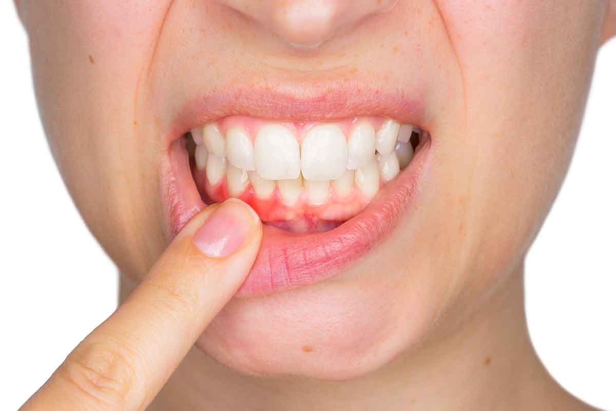 Cho máy Oral B Braun, bộ 4 Đầu Bàn Chải đánh răng điện thay thế MIHOCO EB28-P New Sensitive, làm sạch cao răng, cho nướu nhạy cảm