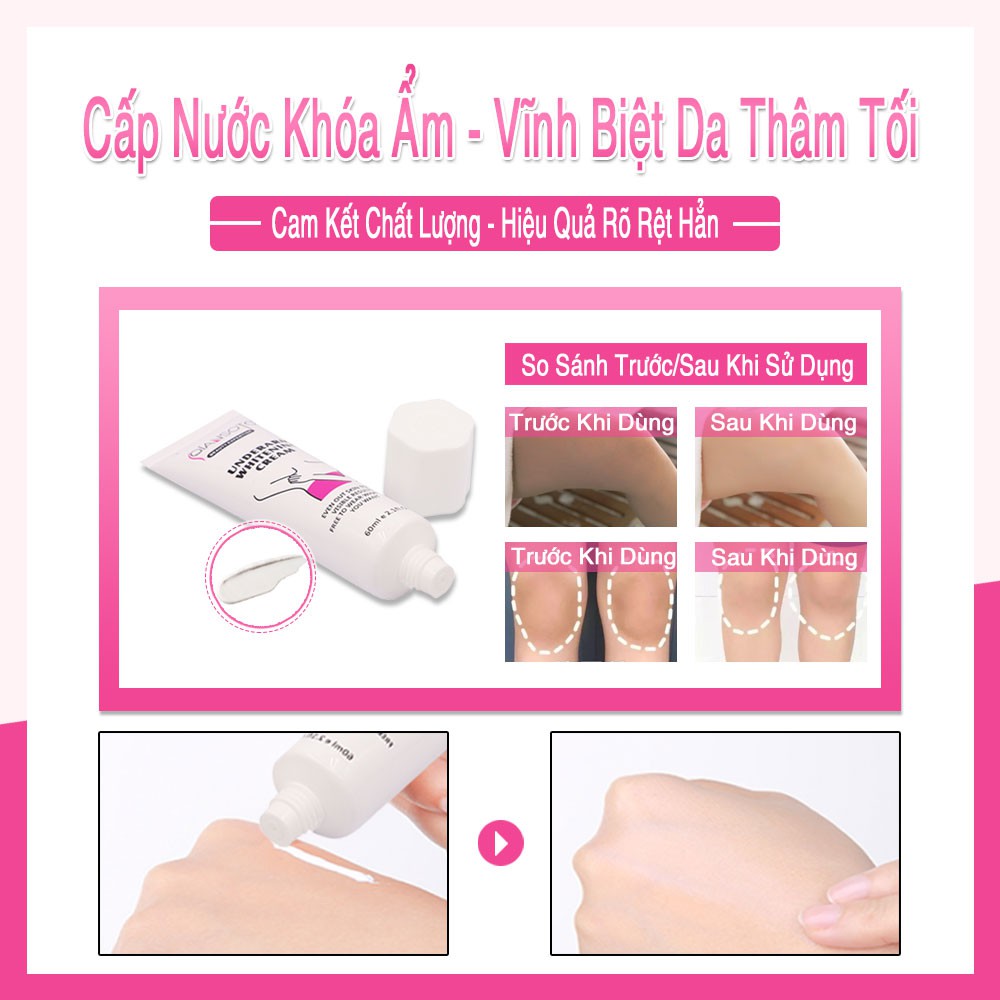 QIANSOTO Kem Giảm Thâm Nách Mông Làm Trắng Da Dưỡng Ẩm Khử Mùi Hôi