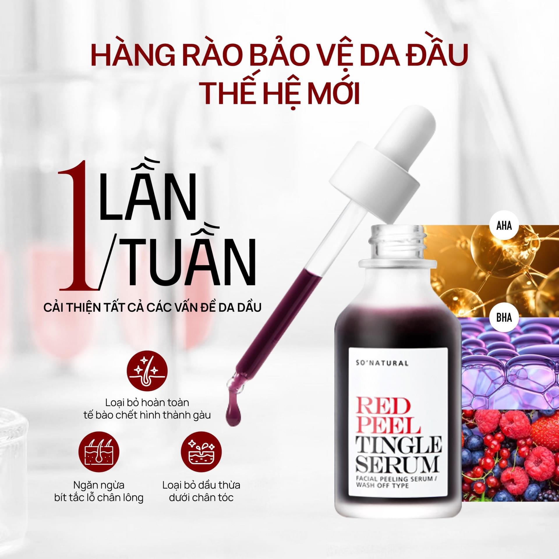 Tinh Chất Thay Da Sinh Học Tẩy Tế Bào Chết da Mặt So’Natural Red Peel Tingle Serum 35ml