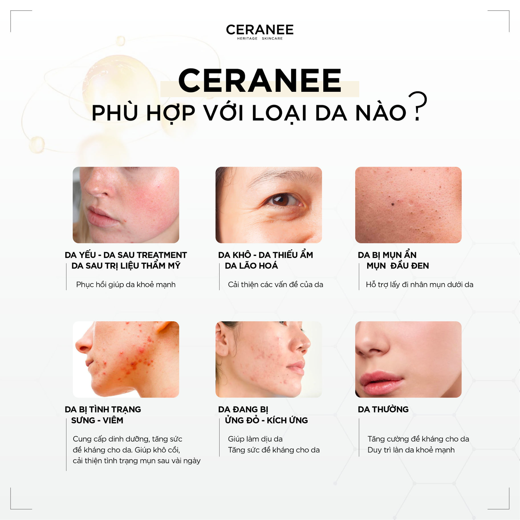 Kem Dưỡng Ẩm Da Làm Trắng Da Phục Hồi Và Chống Lão Hóa Cấp Độ Tế Bào Từ Collagen Tươi Pháp 50gr Ceranee