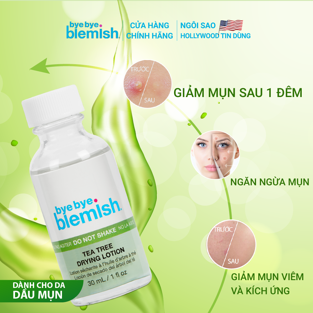 Chấm mụn Tràm Trà giảm mụn nhanh sau 1 đêm dành cho da mụn sưng viêm Bye Bye Blemish Tea Tree Drying Lotion 30ml