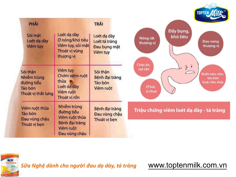 Sữa nghệ curcumin 800g TOPTEN Milk sữa bột cho người bị đau dạ dày tá tràng,phụ nữ sau sinh ,đẹp da