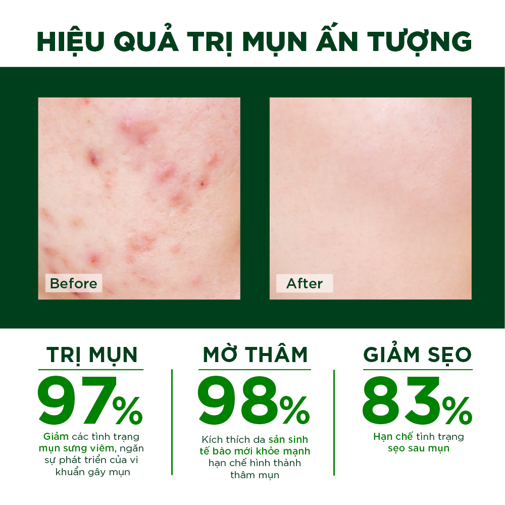 Kem Hỗ Trợ Giảm Mụn Ngừa Thâm Liền Sẹo Ori'be Chiết Xuất Tảo Nâu Từ Pháp Tuýp 20g