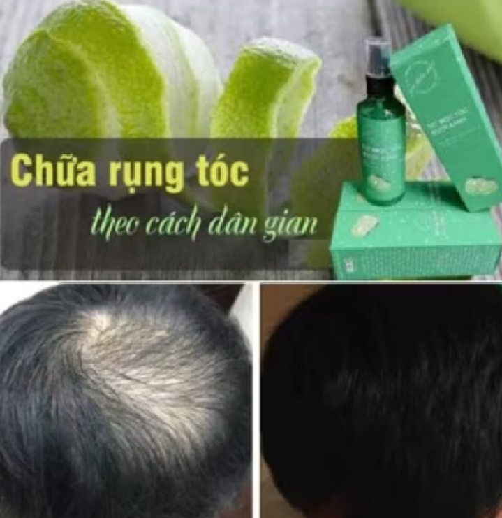 tinh dầu bưởi xịt kích thích mọc tóc loại tốt