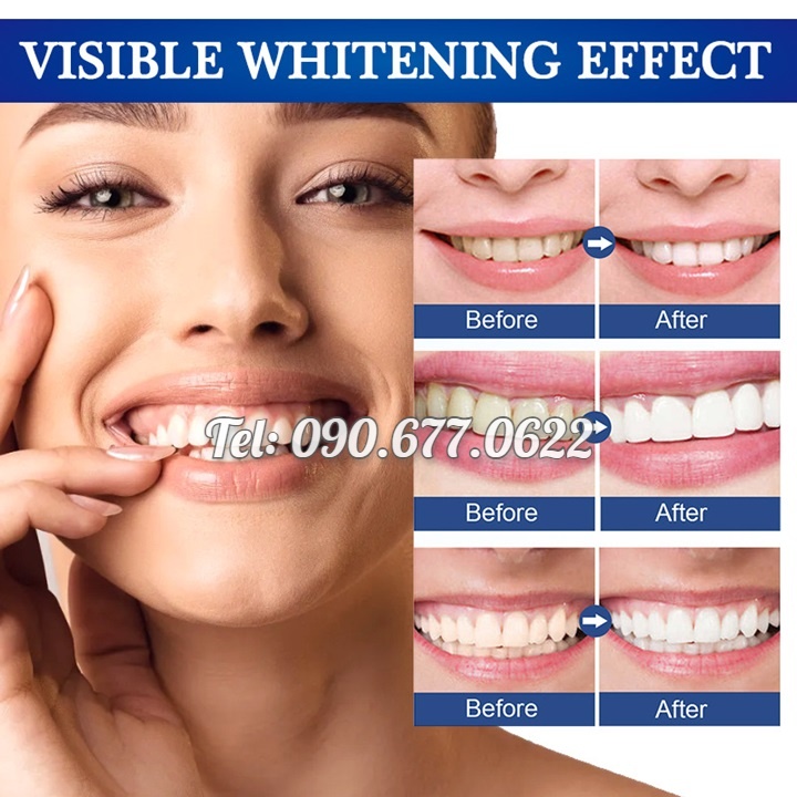 Gel bôi làm trắng, sáng răng, giảm ố vàng, cao răng, giảm hôi miệng và giúp hơi thở thơm tho xuất xứ Nhật Bản – Mã số 1223