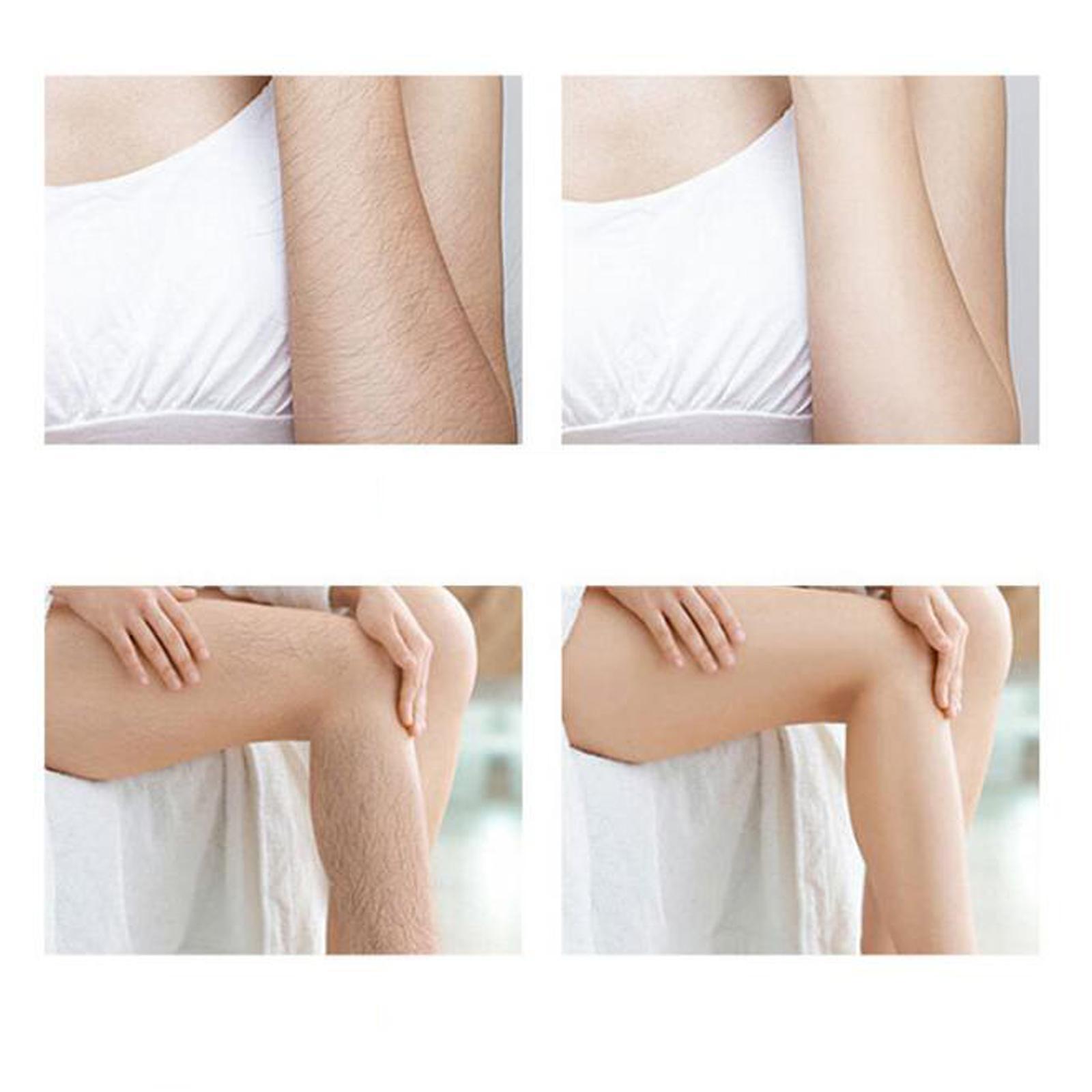 Portable Physical Hair Removal Depilation Hair Eraser for Body