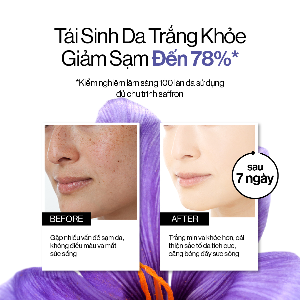 Kem Dưỡng Gilaa Saffron Trắng Khỏe Phục Hồi 50ml