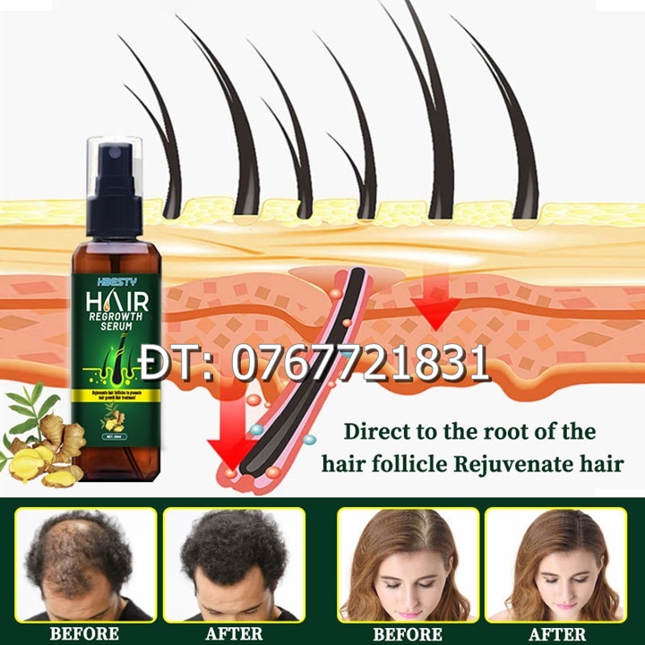 Serum dưỡng mọc tóc, giúp tóc mọc nhanh, nhiều và dày, sợi tóc đen bóng xuất xứ Nhật Bản – Mã số 1230