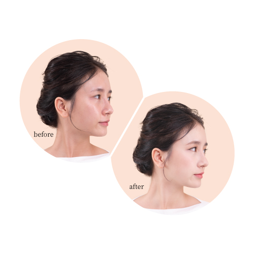 PHẤN MÁ HỒNG HỮU CƠ - naturaglacé CHEEK BLUSH