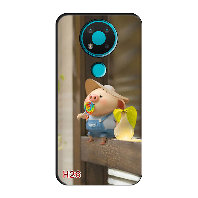 Ốp Dẻo Dành Cho NOKIA 3.4