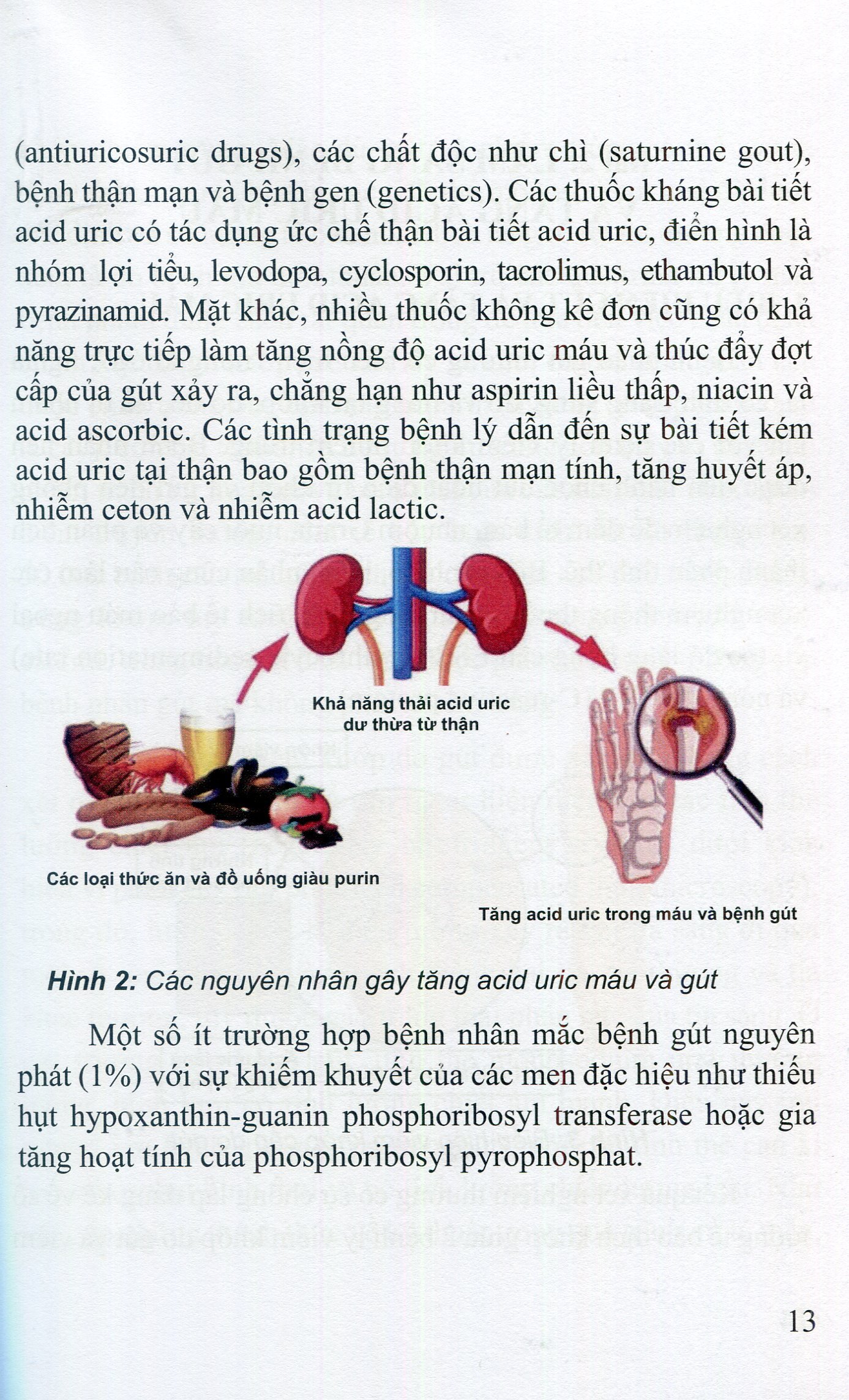 Bệnh Gút - Từ Khoa Học Cơ Sở Đến Thực Hành Lâm Sàng