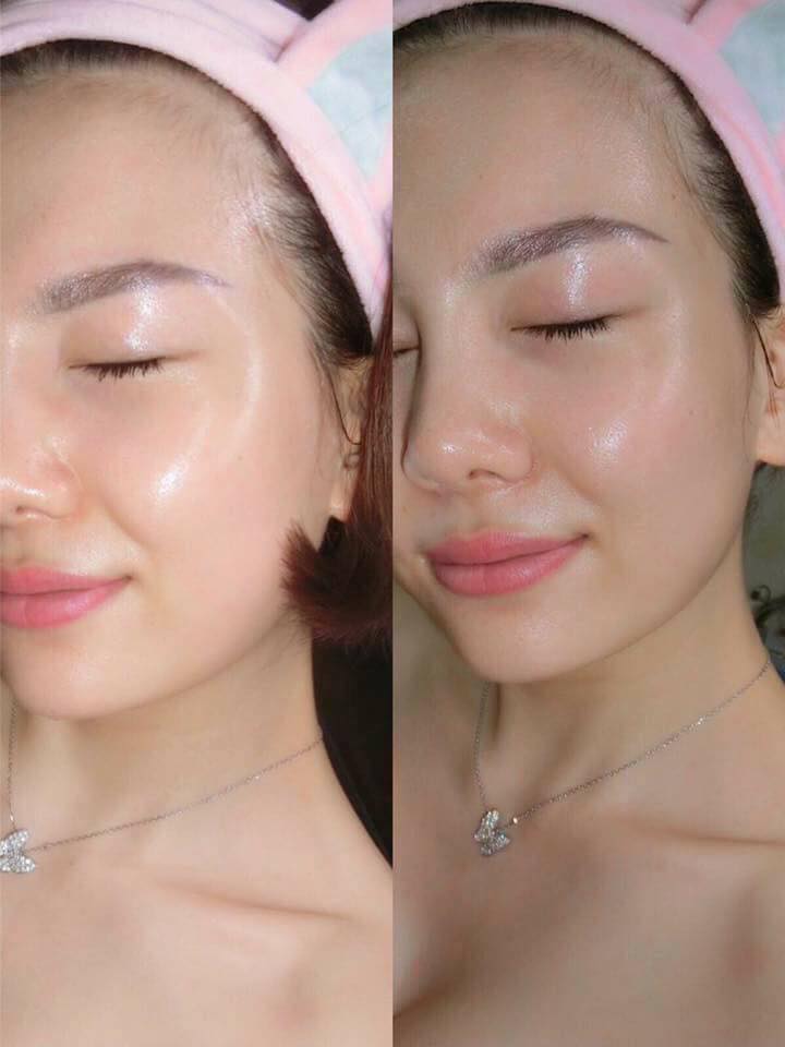 Serum Căng Bóng Da Tinh Chất Cá Hồi MULBERRY - 3 Ngày Dưỡng Trắng Mịn Màng, Thu Nhỏ Lỗ Chân Lông - Sản Phẩm Thay Thế Bortox - Tâm Sinh An Cosmetic