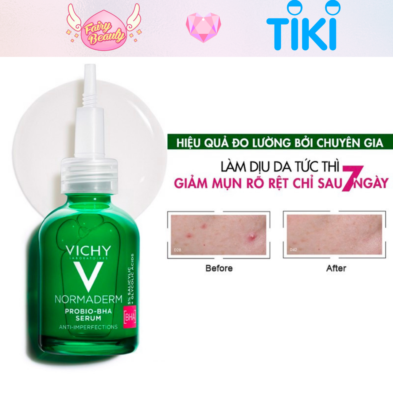 [VICHY] Tinh Chất Giúp Ngăn Ngừa Mụn Và Thu Nhỏ Lỗ Chân Lông Normaderm Probio-BHA Anti Imperfections Serum 30/5/1ml