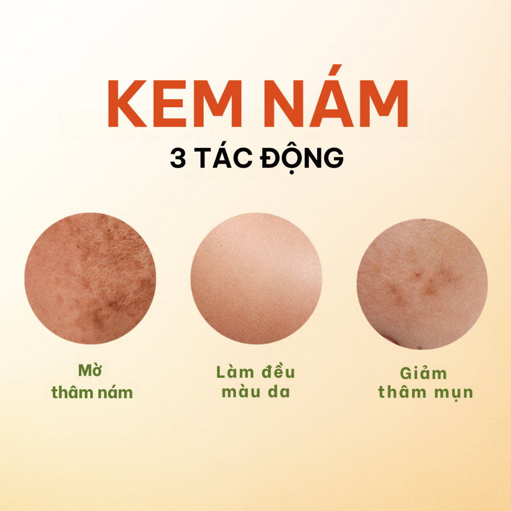 Kem nám Bimore_dưỡng da sáng mịn, giảm mờ thâm nám, tàn nhan_30ml