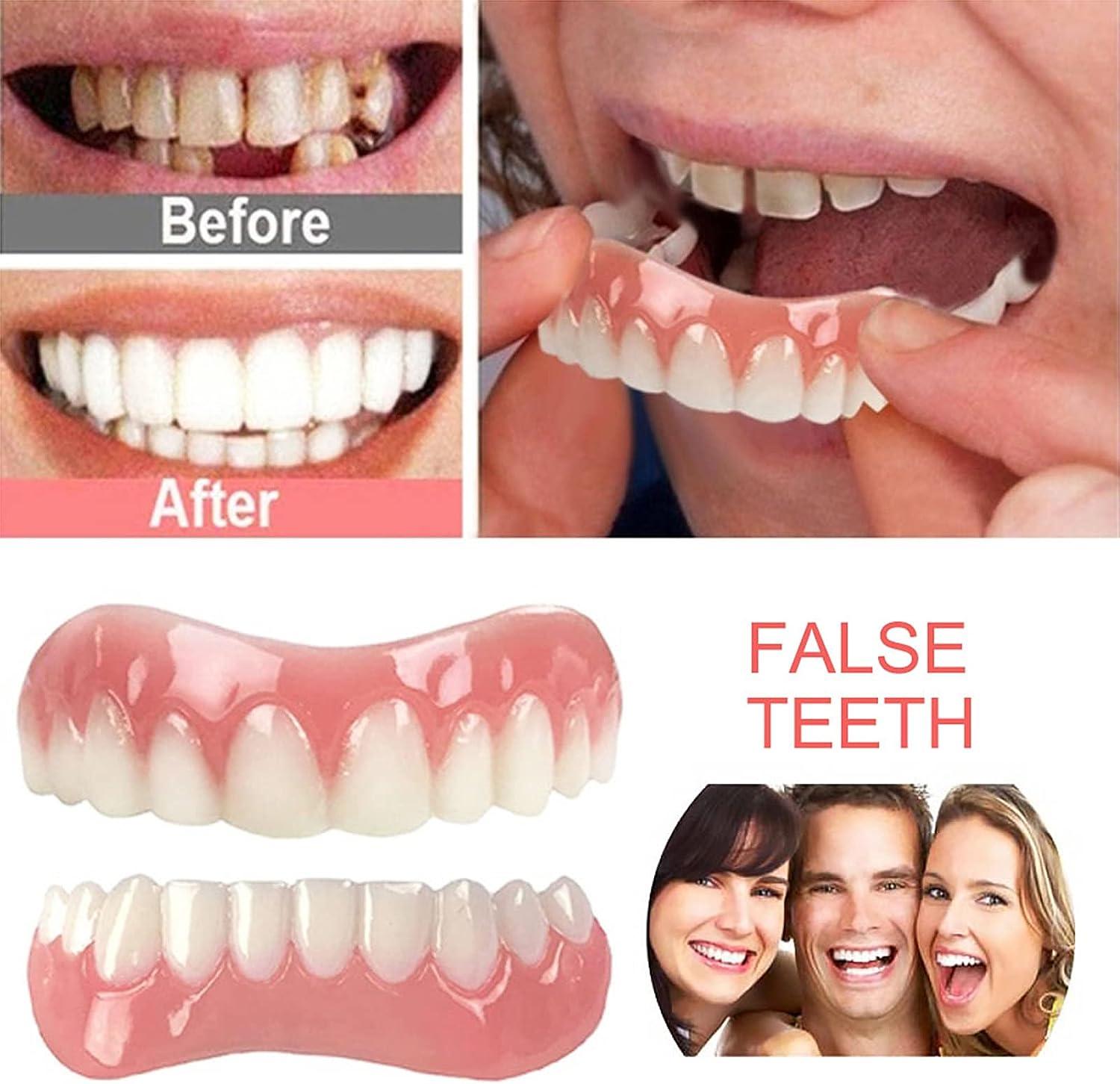 Răng giả Veneer tức thì Thoải mái Nụ cười phía trên Răng trắng Răng thẩm mỹ Răng giả tạm thời Bộ dụng cụ trám răng linh hoạt để che đi những chiếc răng bị mất