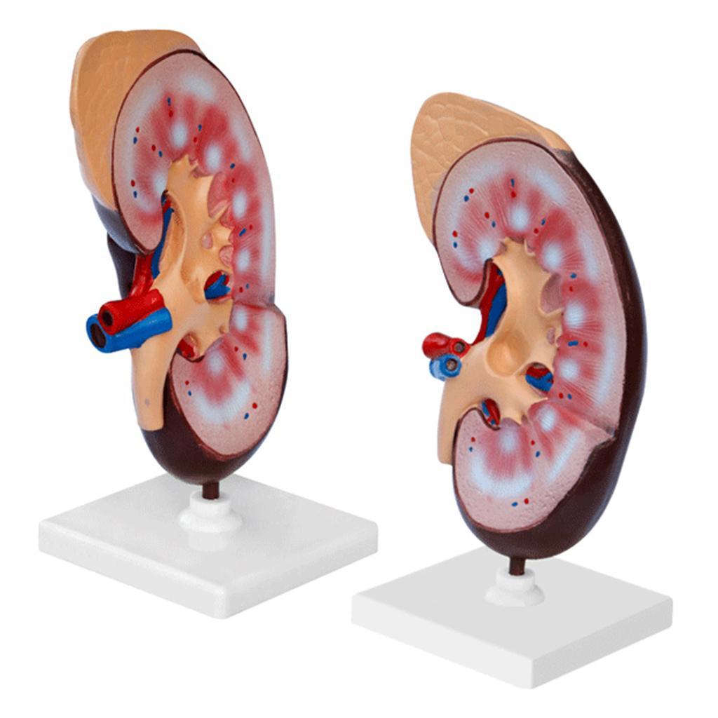 Kidney Anatomical Anatomy Kidney Model Expansion Display Teaching Supplies