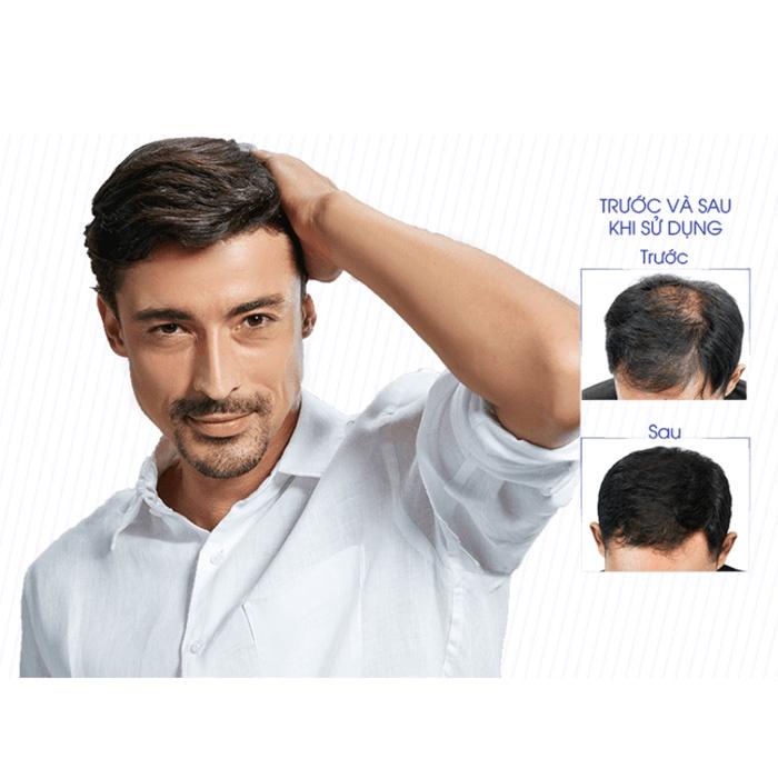 Viên uống QIK HAIR (cho Nam) hỗ trợ giảm rụng, mọc tóc chắc khỏe (15 viên)