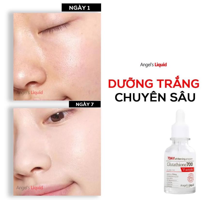 Huyết Thanh Dưỡng Trắng Da, Làm Mờ Thâm Nám Chỉ Trong 7 Ngày Angel's Liquid