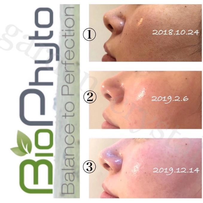 Mặt nạ Christina 4A Herbal Peel giải độc, loại bỏ bã nhờn và tế bào bị hư hỏng - Hee's Beauty