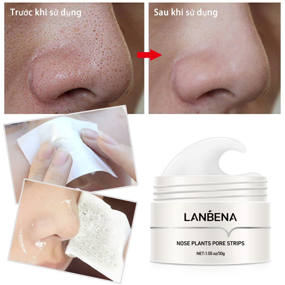 Mặt nạ LANBENA loại bỏ mụn đầu đen cho mũi và mặt hiệu quả 30g