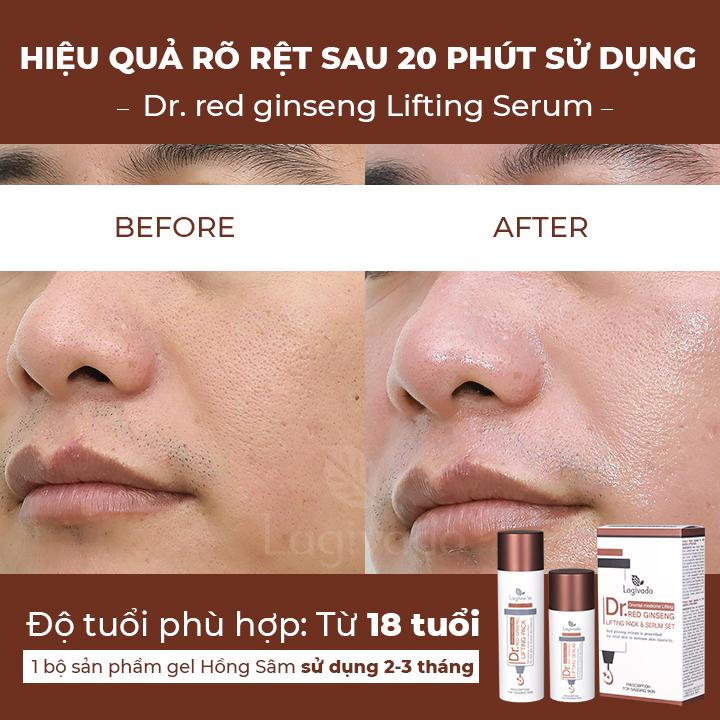 Bộ đôi Gel mặt nạ hồng sâm giảm mụn đầu đen Hàn Quốc Lagivado Dr. Red Ginseng 50 ml và sữa rửa mặt Creamy Foam 50ml