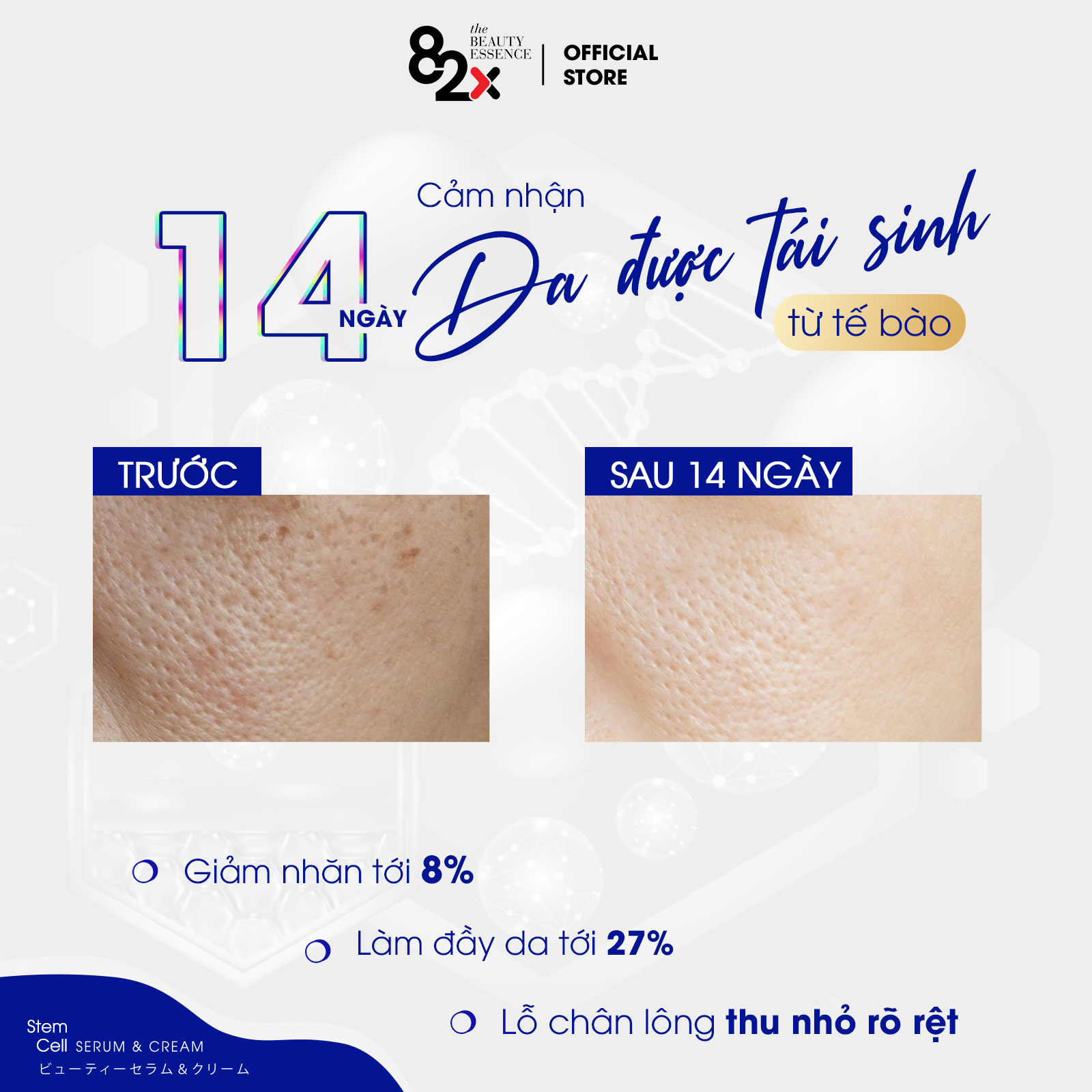 82X AI STEM CELL CREAM kem dưỡng ẩm chuyên sâu và chống lão hóa đến từ Nhật Bản 10mg/hộp.