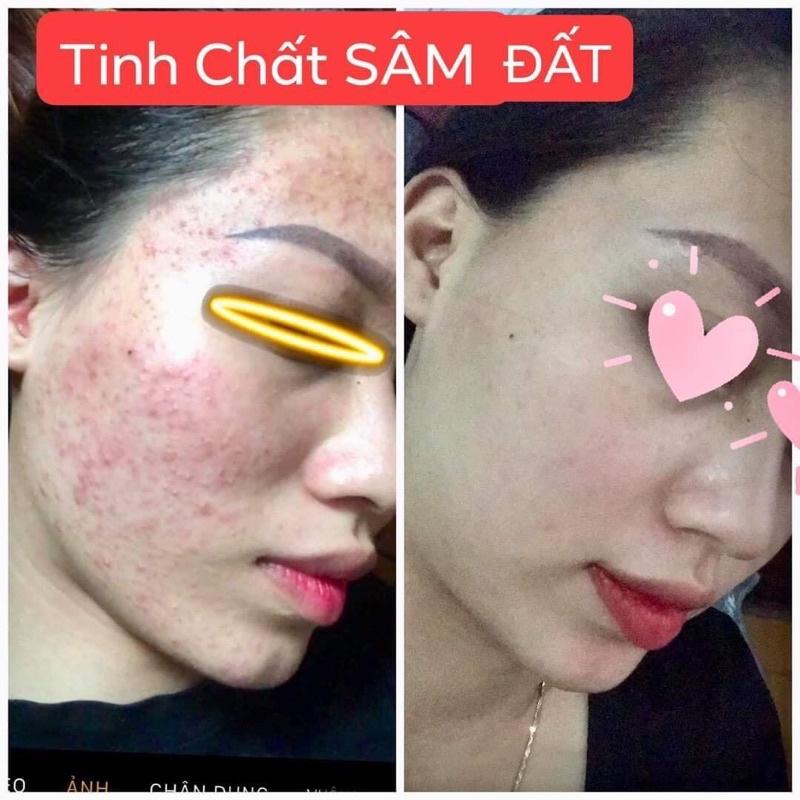 Tinh Chất Sâm Đất DR CELL 50ml