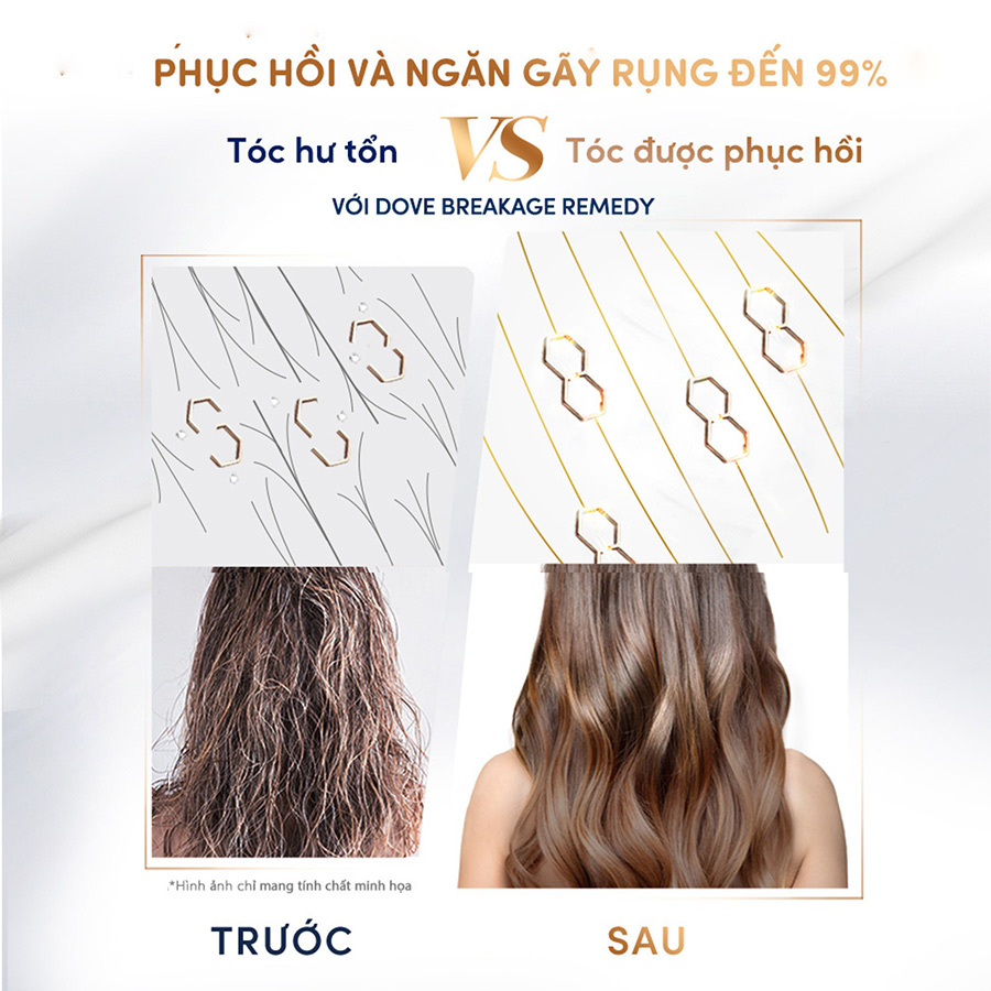 Dầu gội Dove Breakage Remedy Phục hồi và Ngăn gãy rụng 380ml