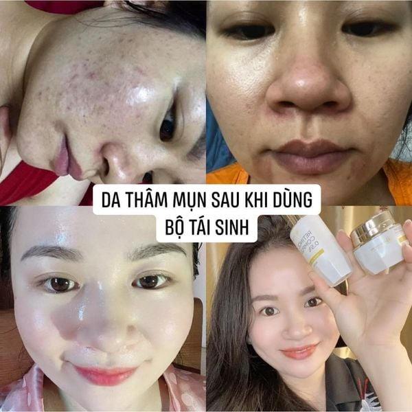 Combo Huyền Phi Cosmetics phục hồi da (Retinol 30ml + Heli B5 Cream30gr)