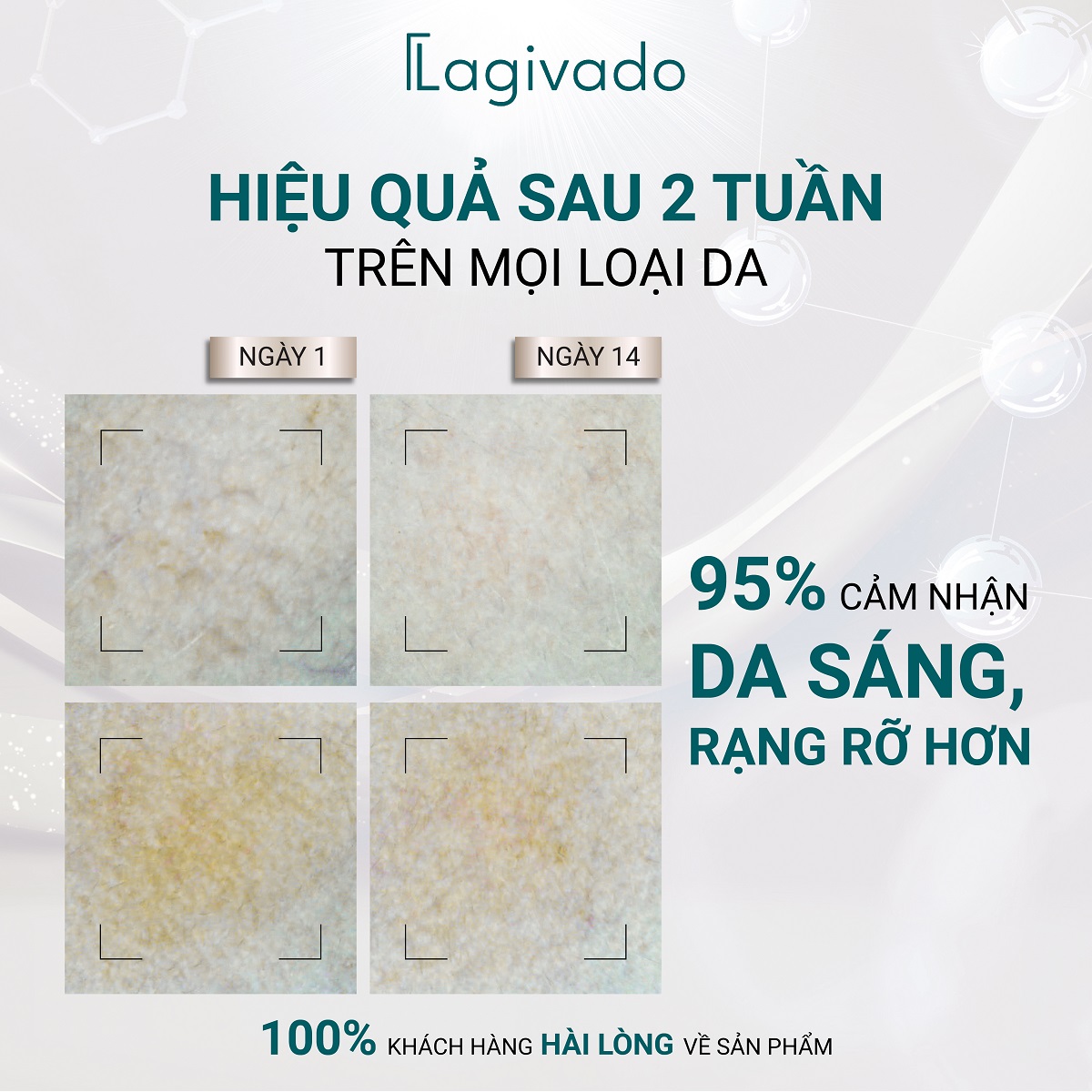 Serum dưỡng trắng da, giúp trẻ hóa và đều màu Lagivado High - L Revital - 50ml