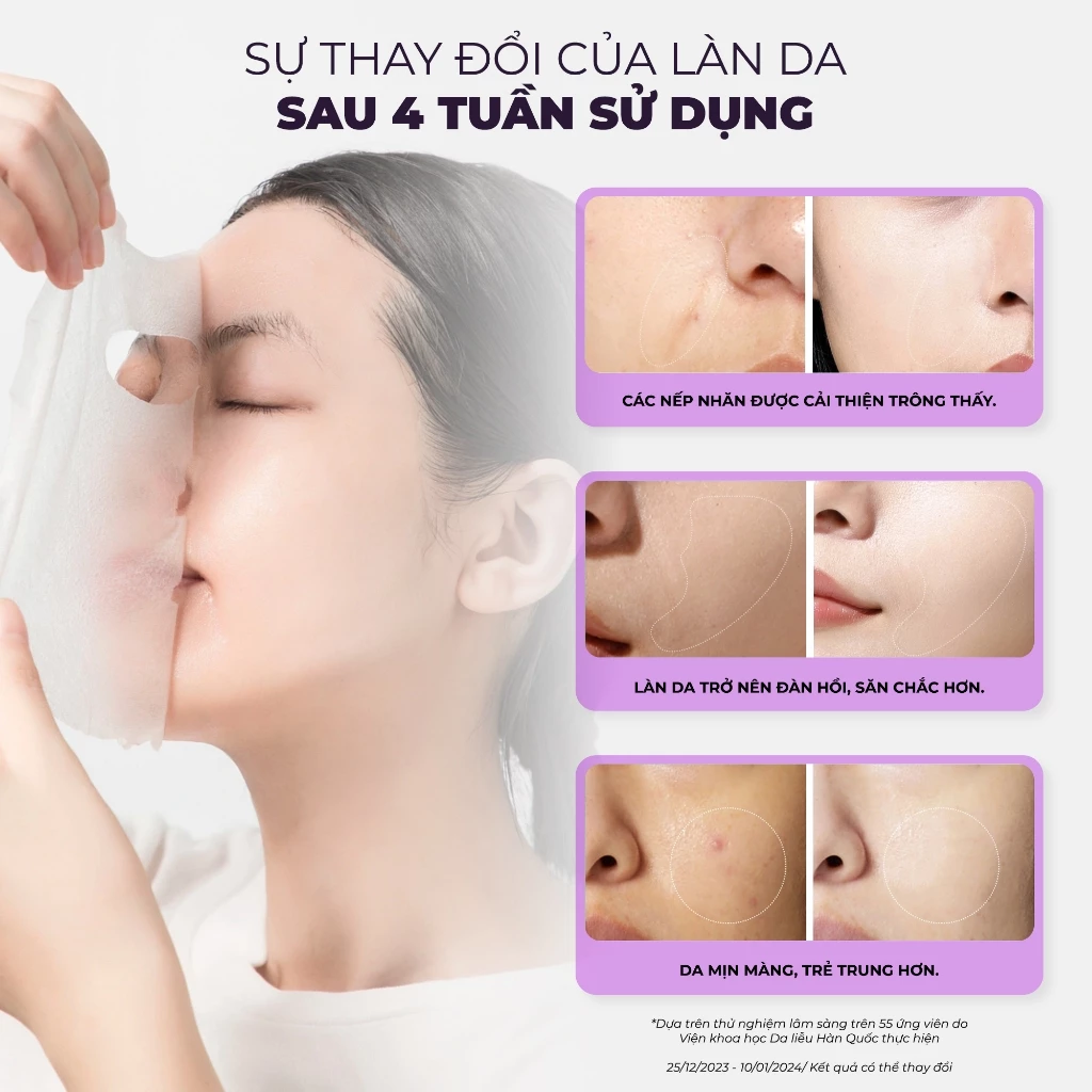 COMBO 10 MẶT NẠ NÂNG CƠ, TRẺ HÓA DA BNBG EXOSOME SKINBOOSTER MASK 30MLX10