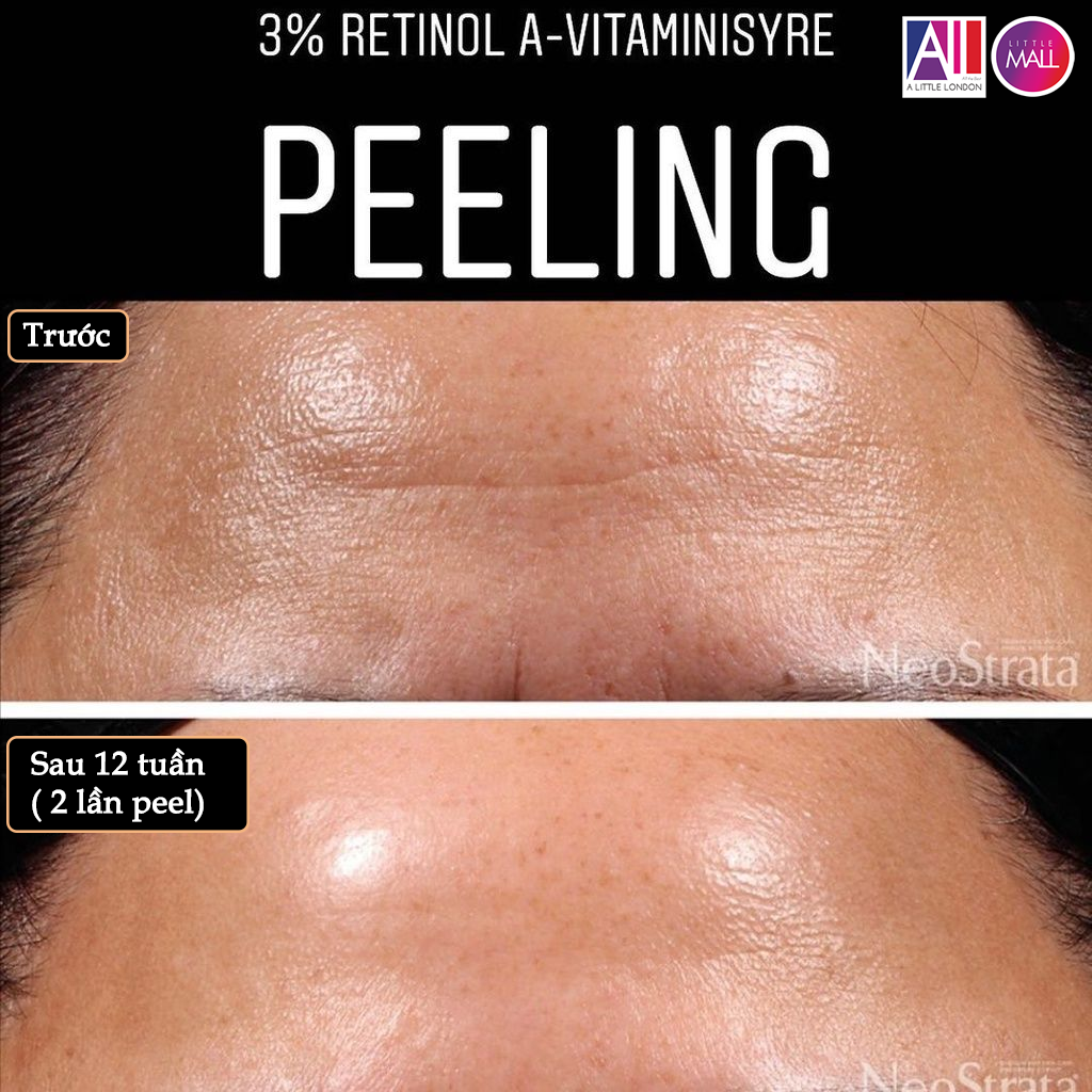 Dung dịch peel sáng da, giảm nhăn Neostrata prosystem 3% retinol peel 1.5ml (Nhập khẩu)