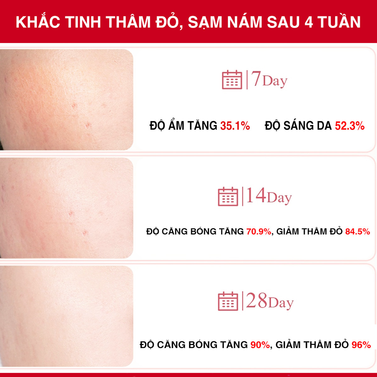 Kem Dưỡng Tranexamic Acid Mờ Nám Chuyên Sâu Angel's Liquid Mela Cream 50ml