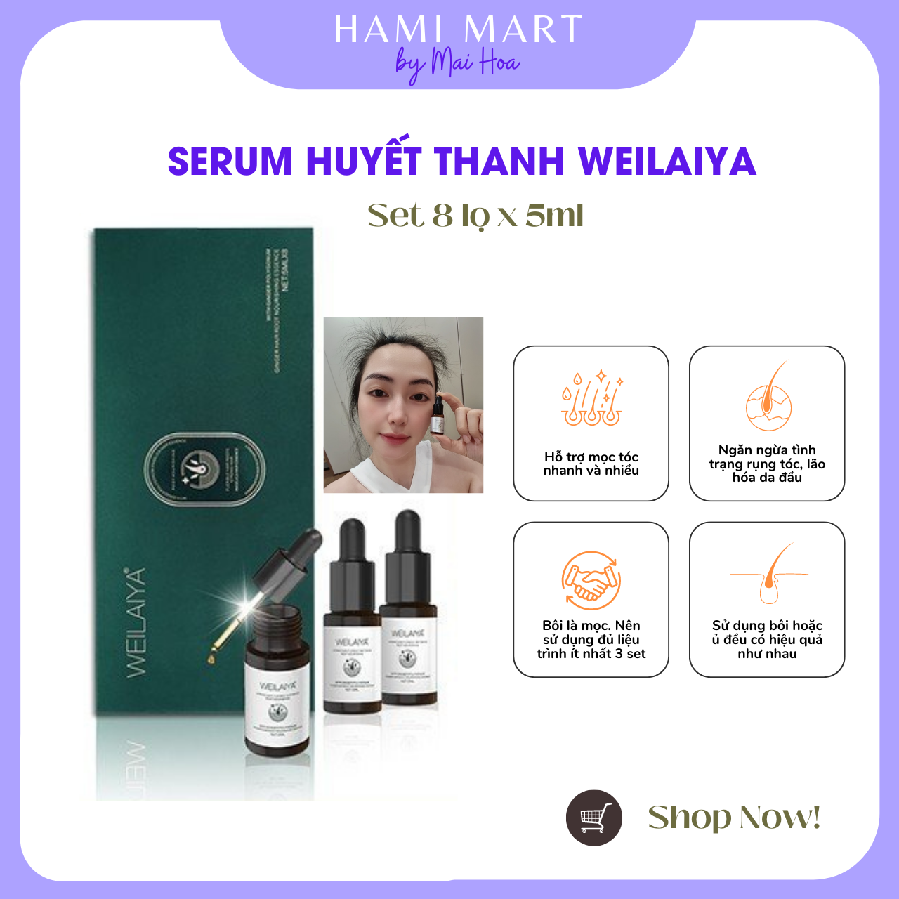 Serum Huyết Thanh Mọc Tóc Weilaiya Hỗ Trợ Giảm Rụng, Kích Mọc Tóc Nhanh - Set 8 Lọ x 5ml