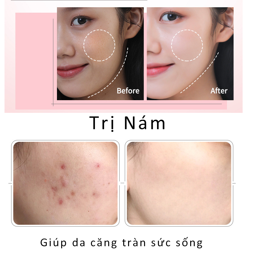 Búa điện di đa năng KNY-D23 tạo ion - làm sạch sâu, Massage, tái tạo collagen cho da mặt