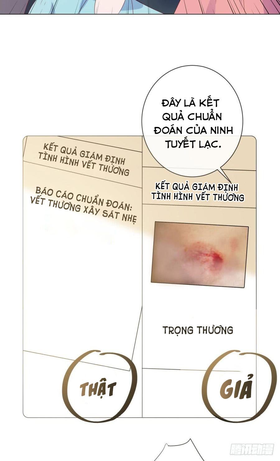 ẩn hôn 100%: chọc tức vợ yêu mua một tặng một chapter 90 16