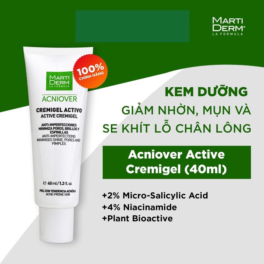 HÀNG NHẬP KHẨU - Kem Dưỡng Martiderm Acniover Cremigel Active Giảm Mụn, Điều Tiết Bã Nhờn, Se Khít Lỗ Chân Lông 40ml