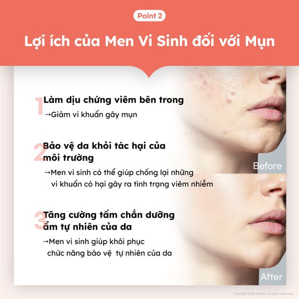 Bột Uống Sorbus Collagen Fish Scale + Vitamin C Cao Cấp Collagen Vảy Cá Cao Cấp, Căng Mịn, Giảm Lão Hóa
