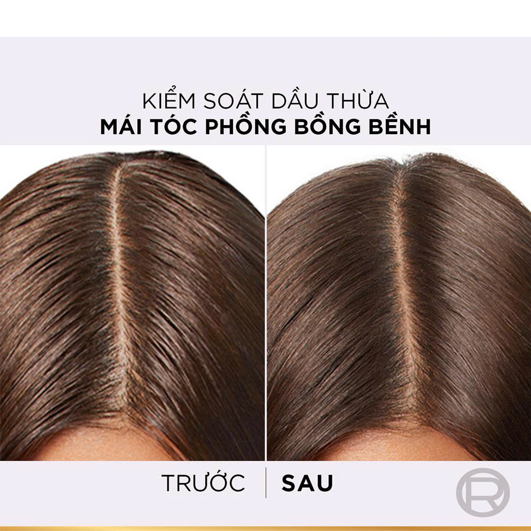 Dầu Xả L'Oreal Tóc Phồng Bồng Bềnh Cho Da Đầu Thường, Dầu