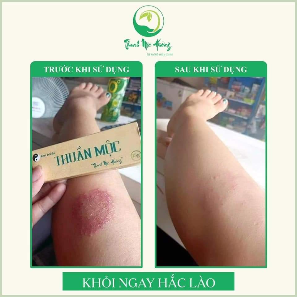 Kem bôi da thuần mộc Thanh Mộc Hương 16g