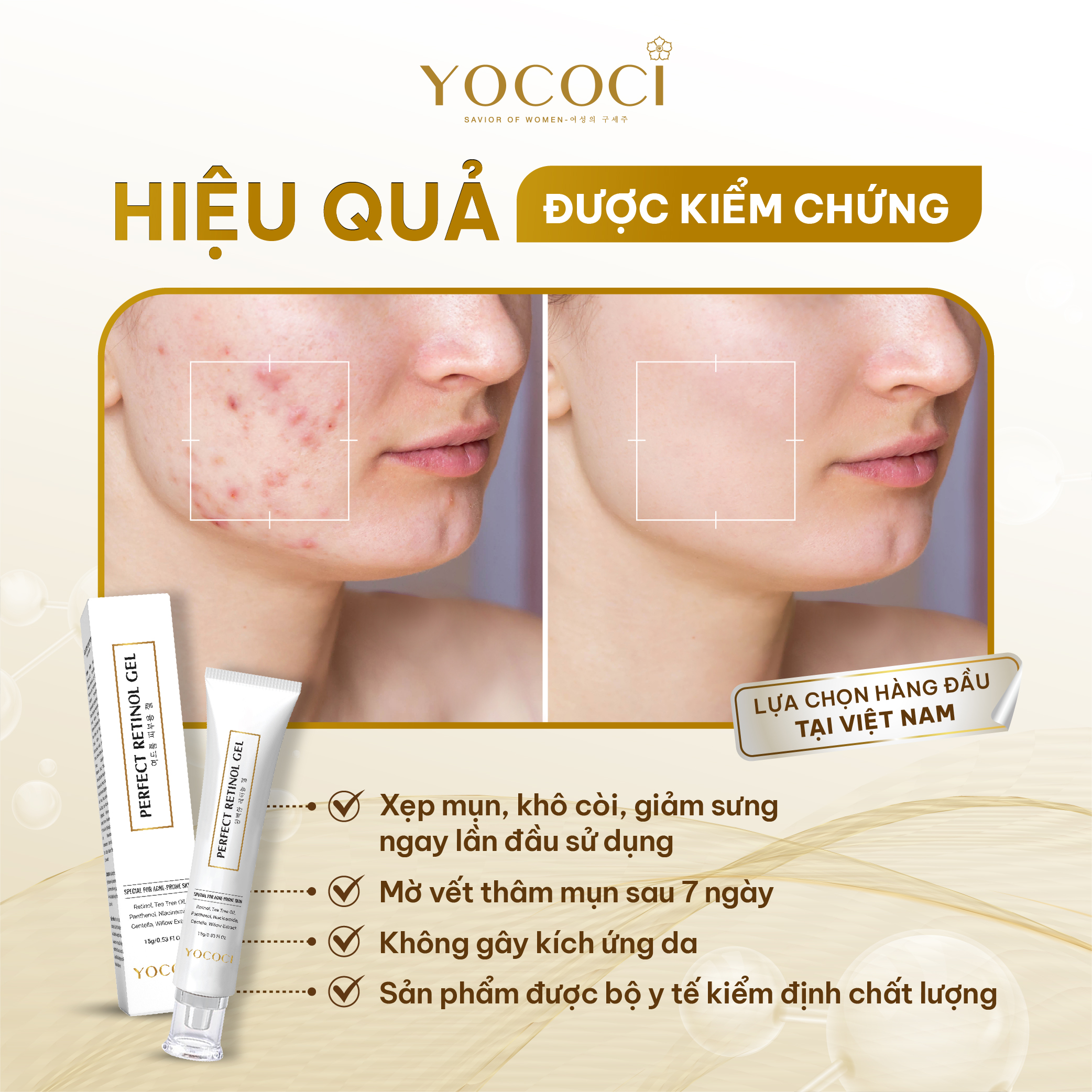 Gel chấm mụn retinol Yococi giảm viêm, khô cồi mụn, xẹp mụn, mờ thâm Perfect Retinol Gel 15g